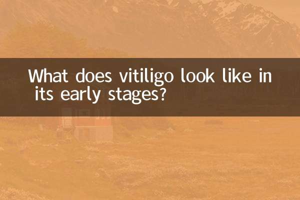 ابتدائی مراحل میں وٹیلیگو کی طرح نظر آتا ہے؟