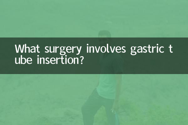 什么手术插胃管