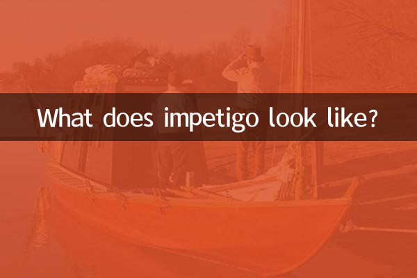 इम्पेटिगो कैसा दिखता है?