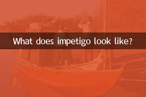 Che aspetto ha l'impetigine?