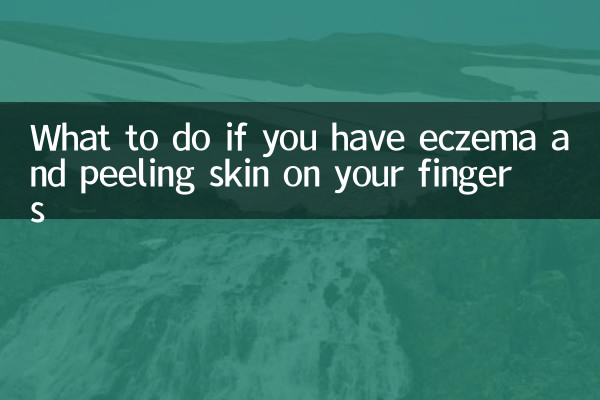手指湿疹脱皮怎么办