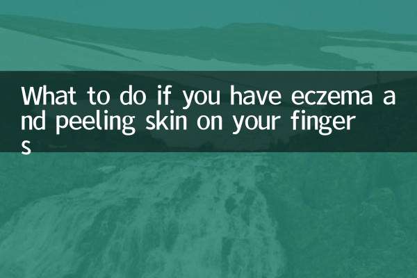 手指湿疹脱皮怎么办