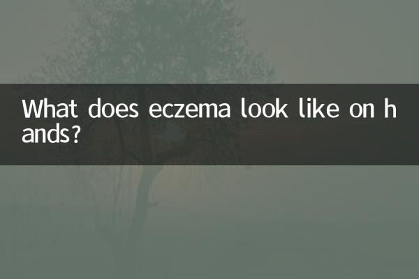 كيف تبدو الأكزيما على اليدين؟