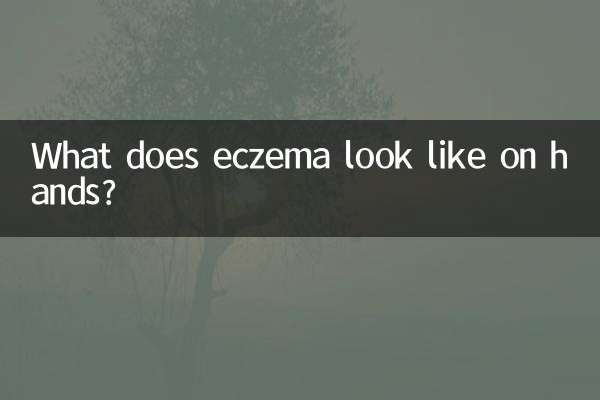 Qual é a aparência do eczema nas mãos?
