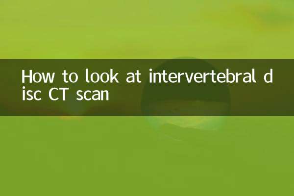 椎間板CTスキャンの見方