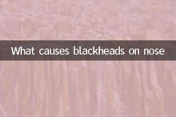 What causes blackheads on nose
