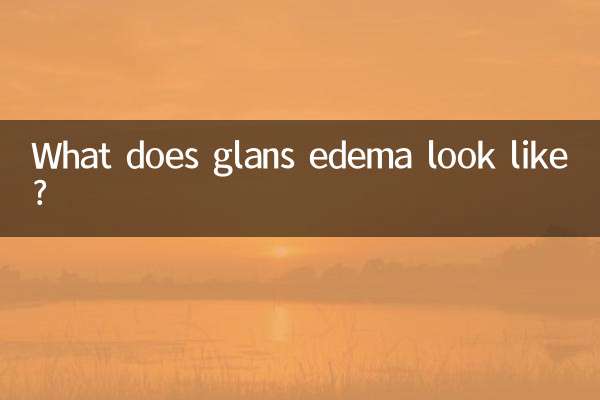 What does glans edema look like?