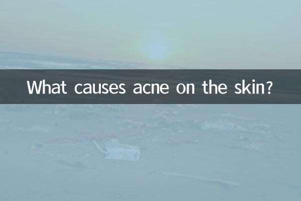 ¿Qué causa el acné en la piel?