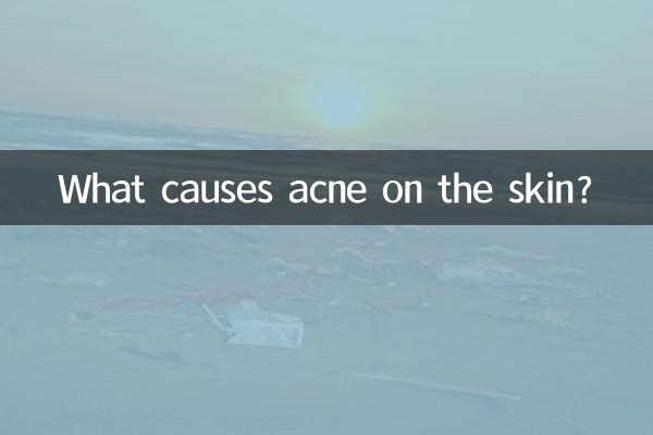 Was verursacht Akne auf der Haut?