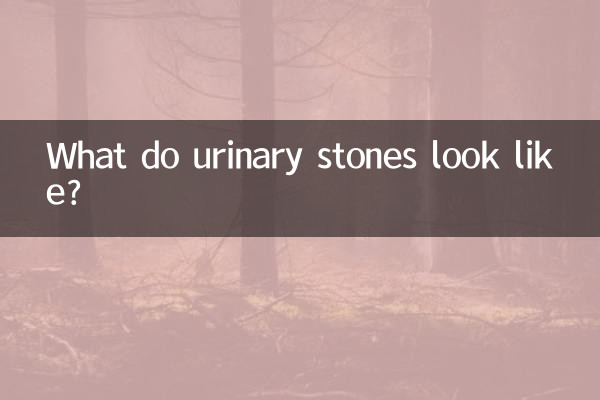 كيف تبدو حصوات المسالك البولية؟