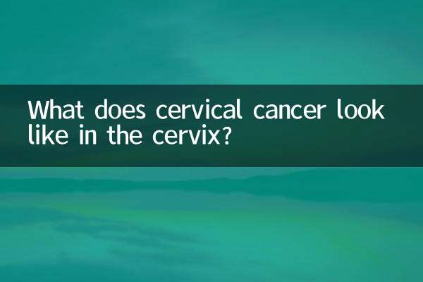 What does cervical cancer look like in the cervix?