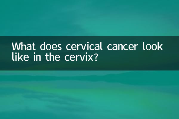 گریوا میں گریوا کینسر کی طرح لگتا ہے؟