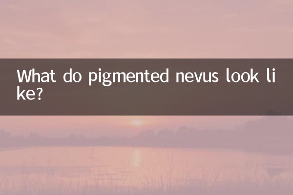What do pigmented nevus look like?