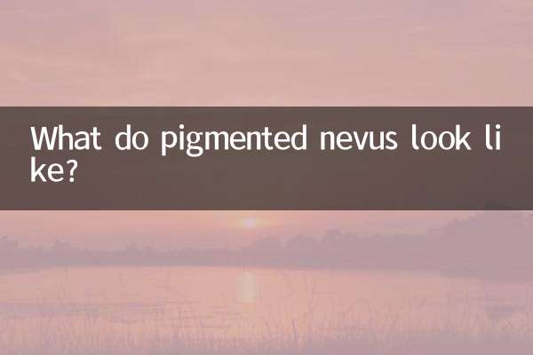What do pigmented nevus look like?