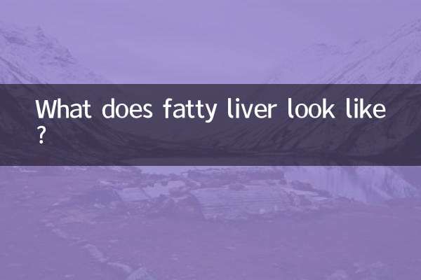 फैटी लीवर कैसा दिखता है?