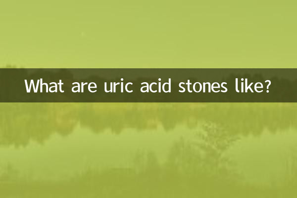 What are uric acid stones like?