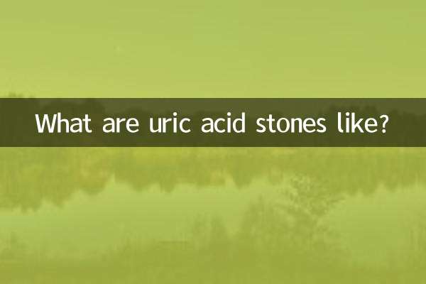 What are uric acid stones like?