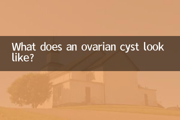 كيف يبدو كيس المبيض؟