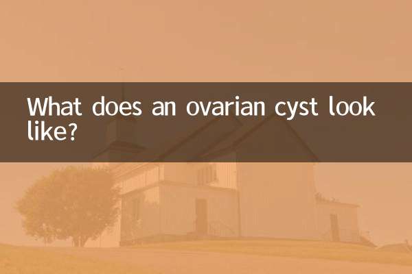 كيف يبدو كيس المبيض؟