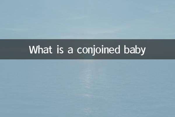What is a conjoined baby
