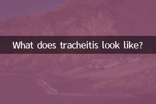 What does tracheitis look like?