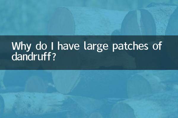 ¿Por qué tengo grandes manchas de caspa?