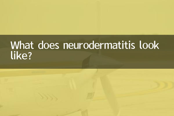 A quoi ressemble la névrodermite ?