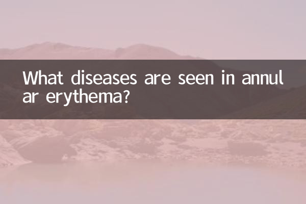 환상 홍반에는 어떤 질병이 나타납니까?