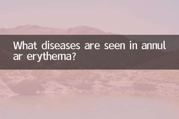 环形红斑见于什么病
