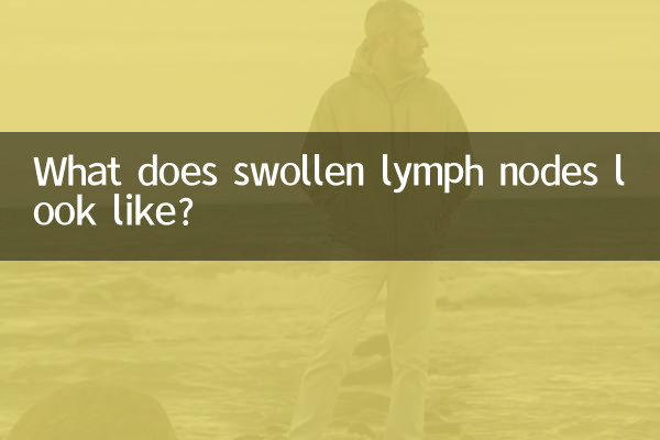 كيف تبدو الغدد الليمفاوية المنتفخة؟